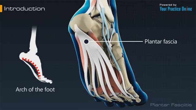 Foot & Ankle Videos - Golden State Orthopedics & Spine