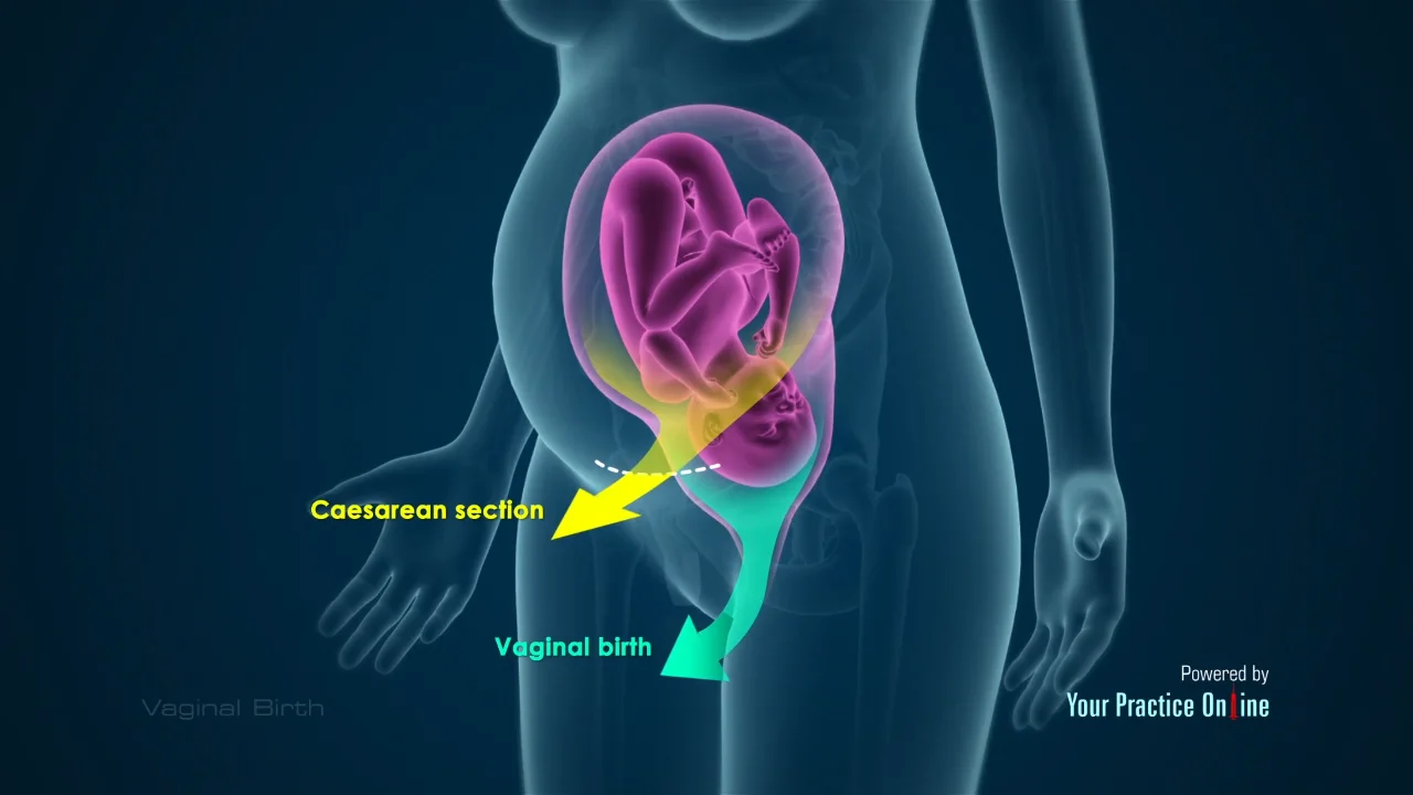 Nijniy Novgorodda fohishalarni qayerdan topish mumkin