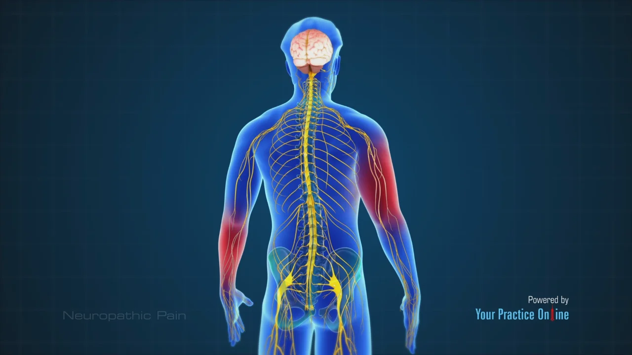 Neuropathic Pain