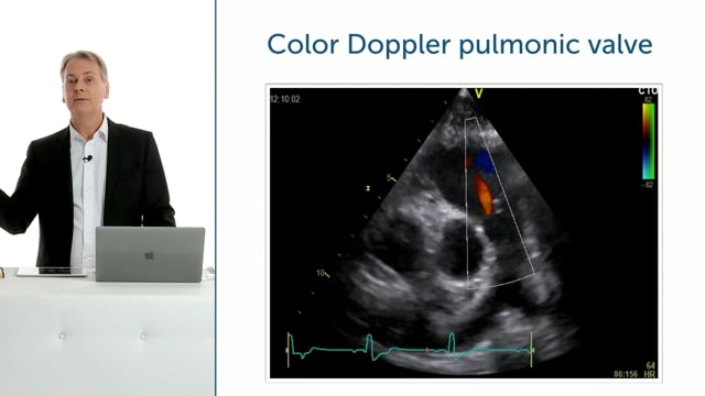 What can I find when I use color Doppler in a PSAX?