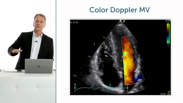 How can I use color Doppler to assess the Mitral valve?