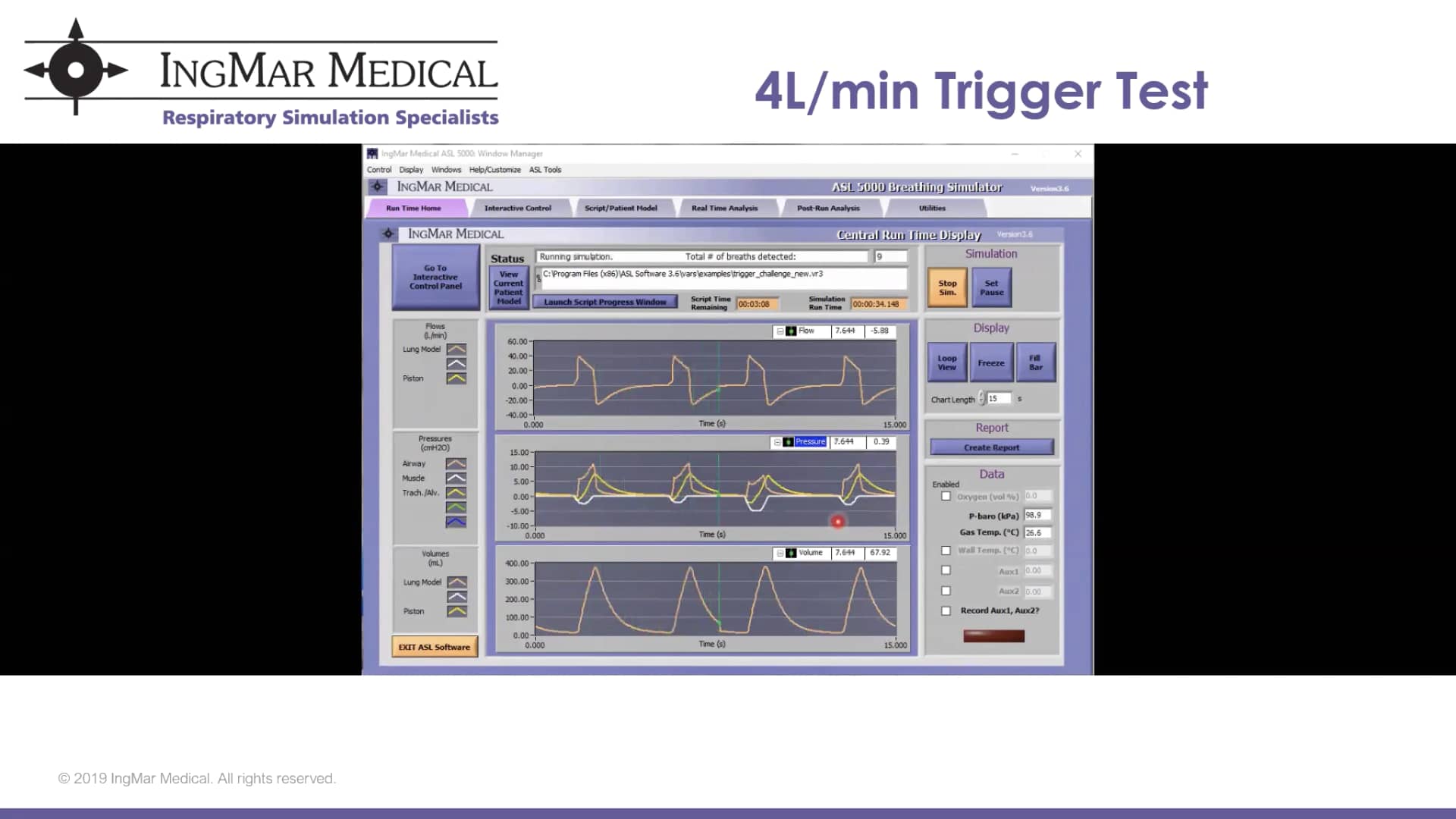 Ventilator Trigger Sensitivity with the ASL 5000™ on Vimeo