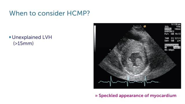 What findings can I expect in HCMP?
