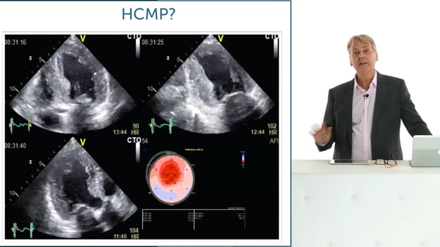 Does this patient have HCMP or HTN?
