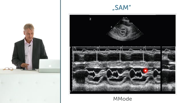 What is SAM and how can I recognize it?