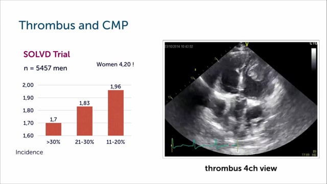 What role does a thrombus play in patients with cardiomyopathy?
