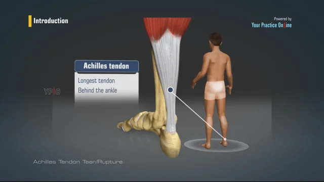 Patellar Tendon Repair Amarillo, TX  Patella Tendon Rupture Treatment  Amarillo