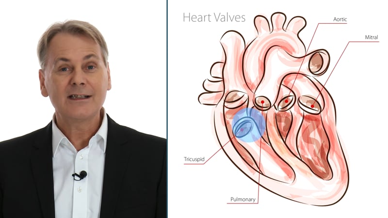 How is MS associated with rheumatic fever?