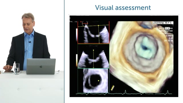 How important is it to measure the exact MVA?