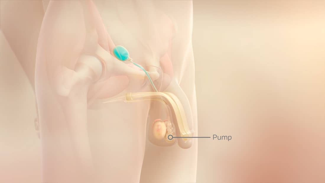 ミューズED治療オンライン