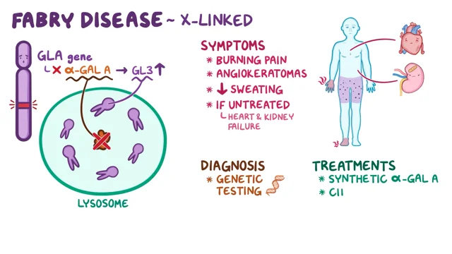 Gaucher Disease - Symptoms, Causes, Treatment