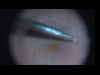 Pucker Pinch and Peel 8-19