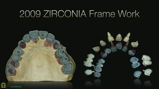 #3 Zirconia Crown適応症