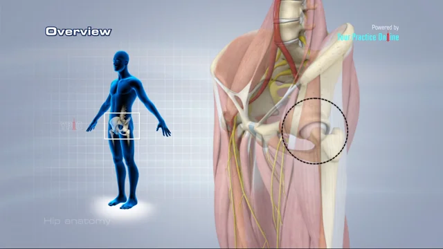 Normal Hip Joint Anatomy & Total Hip Replacement 3D Videos, Houston Texas