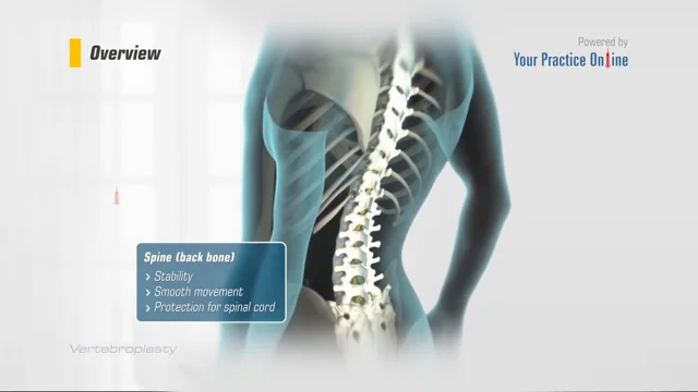 Compression Fracture » Hamilton Orthopaedics, Spine & Sports Medicine