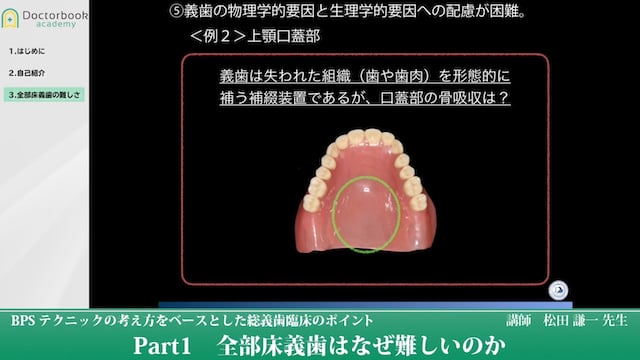 全部床義歯はなぜ難しいのか #1