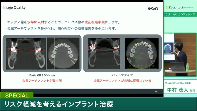 #3 上側切歯抜歯即時埋入症例