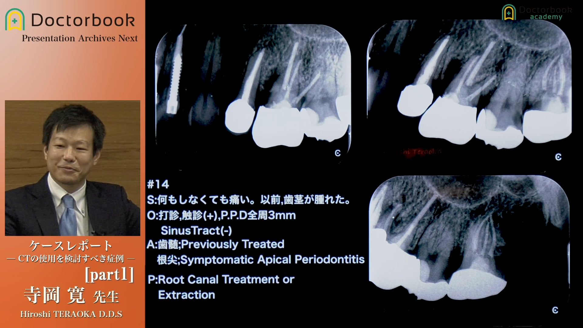 #1 CTの適応症