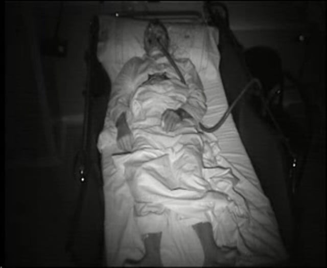 Sleep movements in anti-IgLON5 disease (2)