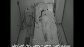 Periodic leg movements in sleep
