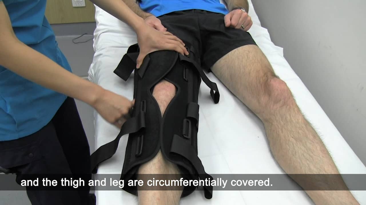 Zimmer Splint on Vimeo