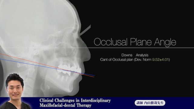 ⑬Clinical Challenges in Interdisciplinary Maxillofacial-dental Therapy