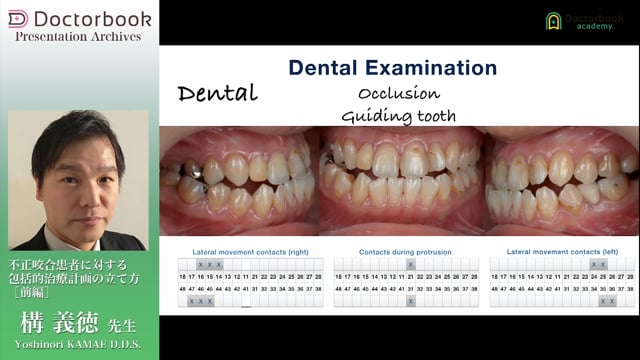 不正咬合患者に対する包括的治療計画の立て方 | Doctorbook academy 