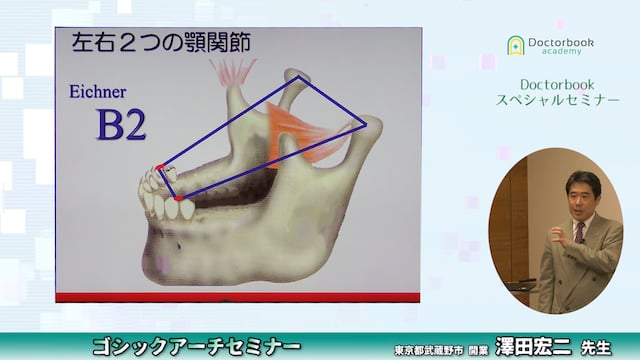 ゴシックアーチ 