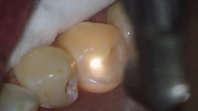 Solea Class I #29 O - Dr. David Fantarella