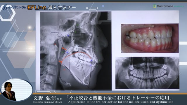 2 顎顔面の成長発育 | Doctorbook academy (ドクターブックアカデミー)