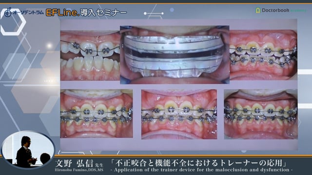 #7 EF line.の強みとポイント：様々な現地症例