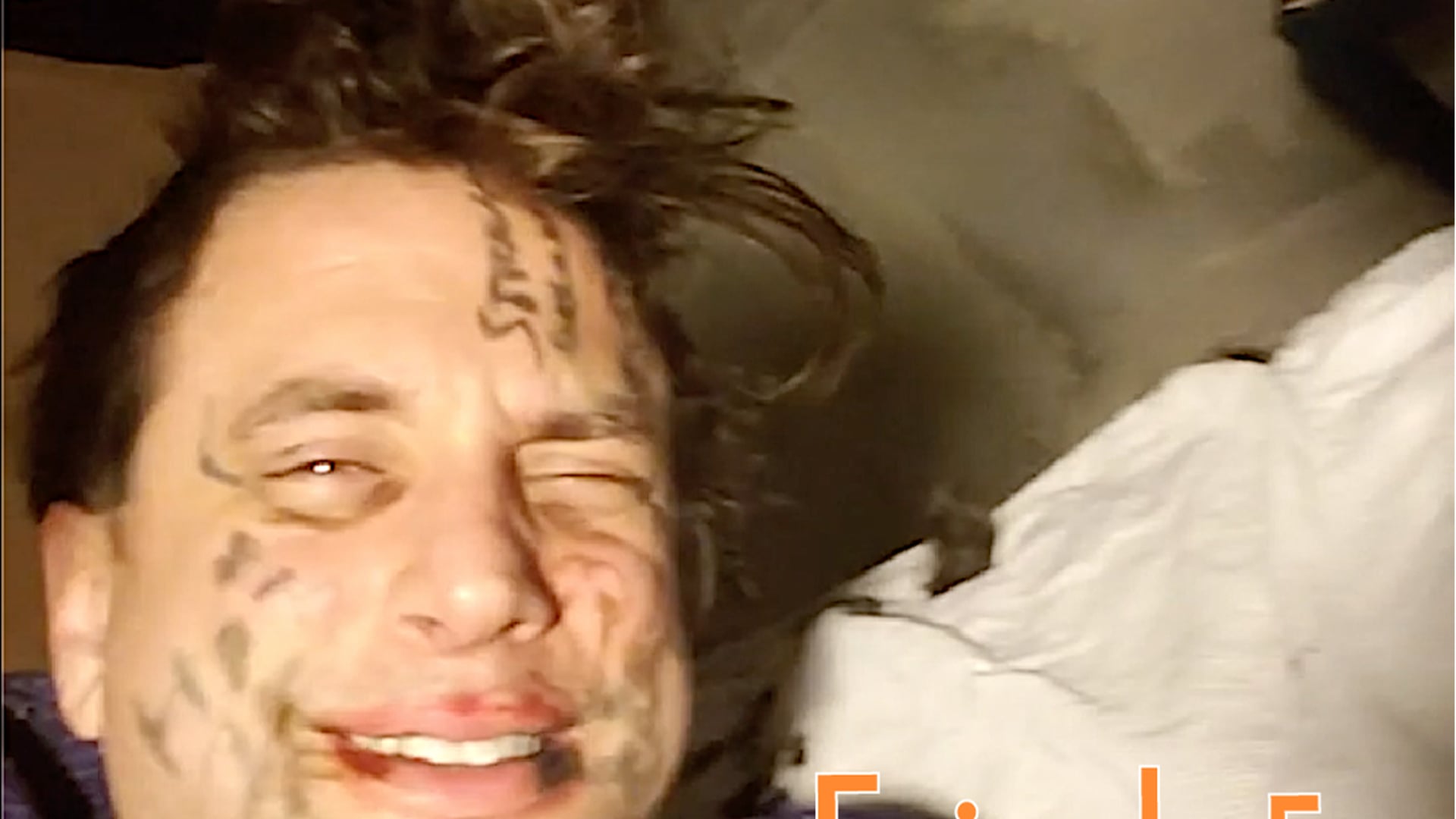 LOSER - Episode 5: Dean Loses His Hair