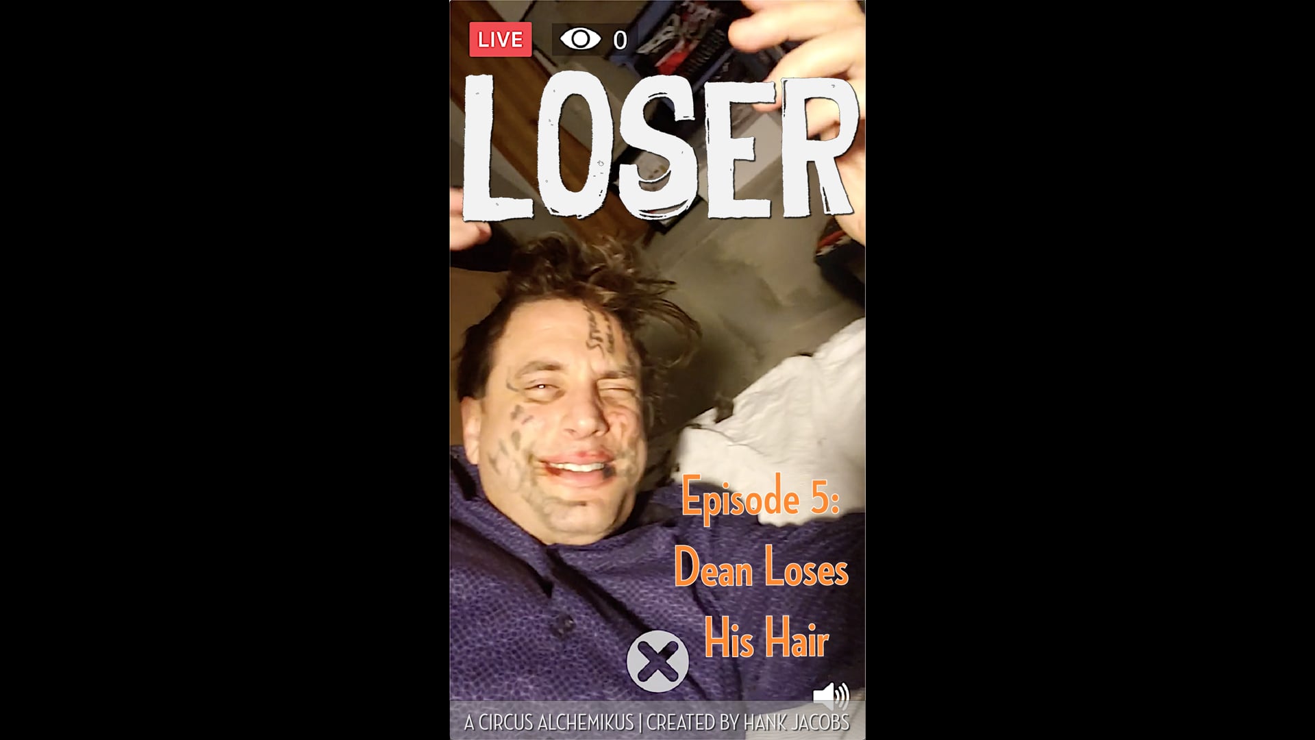 LOSER - Episode 5: Dean Loses His Hair