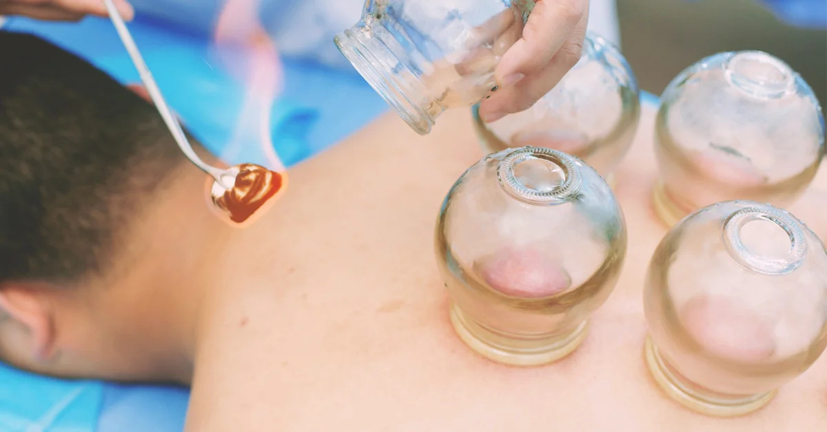 EDGE Cupping Therapy Tutorial by Dr. Joi on Vimeo