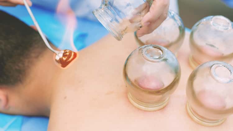 Health 360: Learn All About Cupping Therapy & The Many Health Benefits on  Vimeo