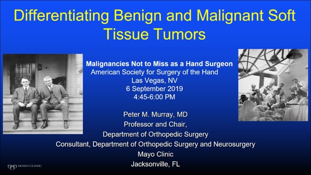 HERO: Benign Bone And Soft Tissue Tumors