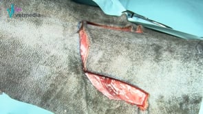 Colgajo monopediculado de avance simple o bilateral irrigado por el plexo subdermal profundo