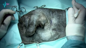 Colgajo axial auricular caudal