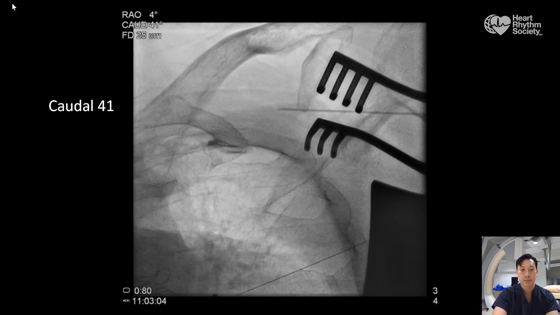 Expert Perspective: A Message From A Heart Rhythm Society Member ...