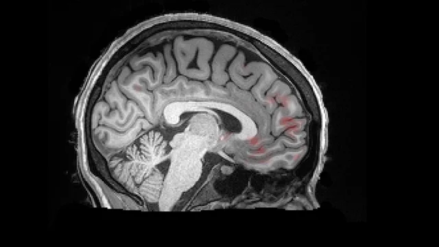 Cerebrospinal Fluid "Brain Washing" During Sleep | The Brink | Boston  University