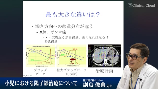 小児における陽子線治療について