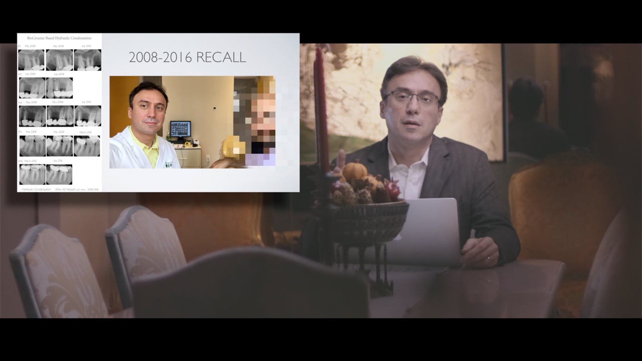 Friday Questions Splitting a fractured tooth after Hydraulic