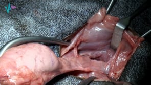 Sialodectomía o escisión de las glándulas salivares