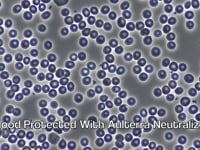 Blood Microscopy with the Aulterra Neutralizer
