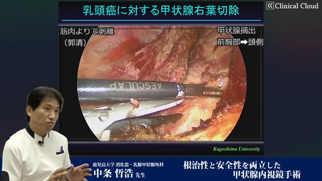 中条 哲浩先生：根治性と安全性を両立した甲状腺内視鏡手術