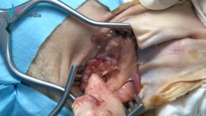Ablación total del conducto auditivo externo y osteotomía lateral de la bulla timpánica en un perro