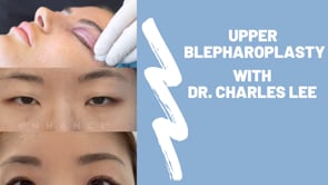Upper Blepharoplasty Procedure with Dr. Charles Lee