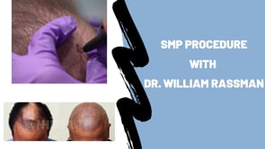 SMP (Scalp Micropigmentation) with Dr. William Rassman