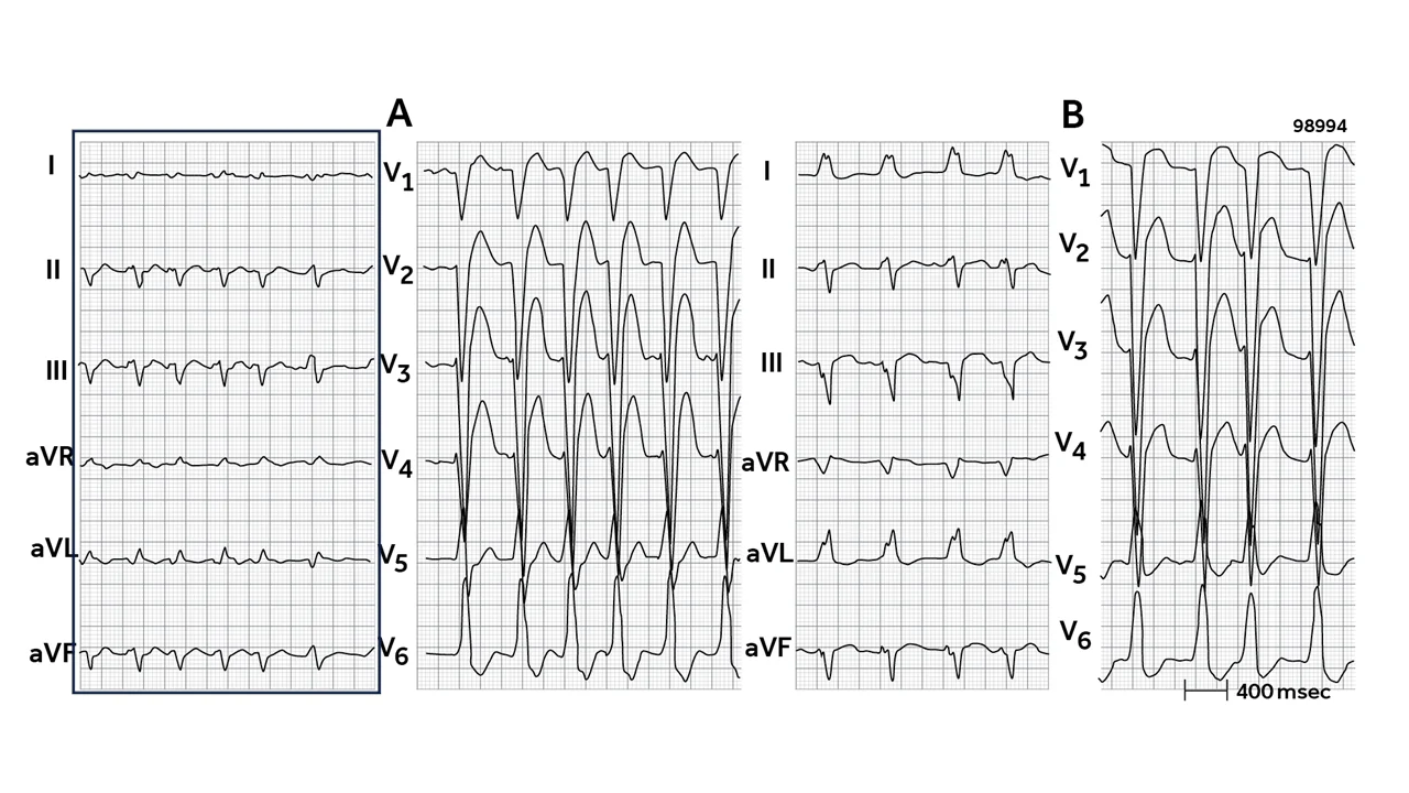 Sunday Lecture - ECG 14_2 on Vimeo