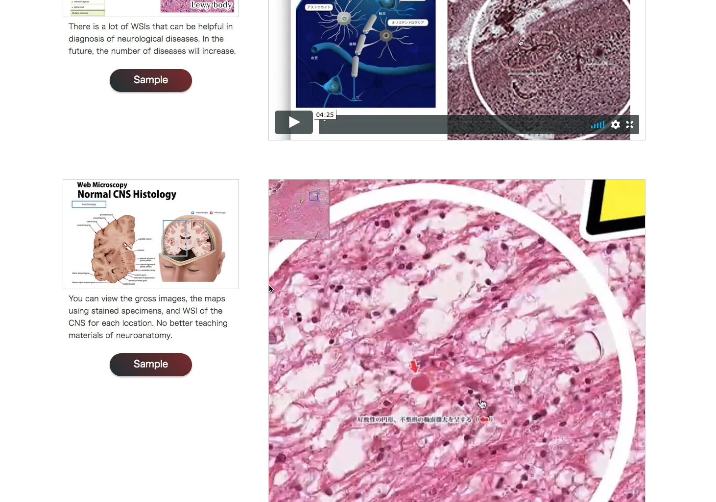 神経解剖・病理の包括的eラーニングシステム（英語版）が本格